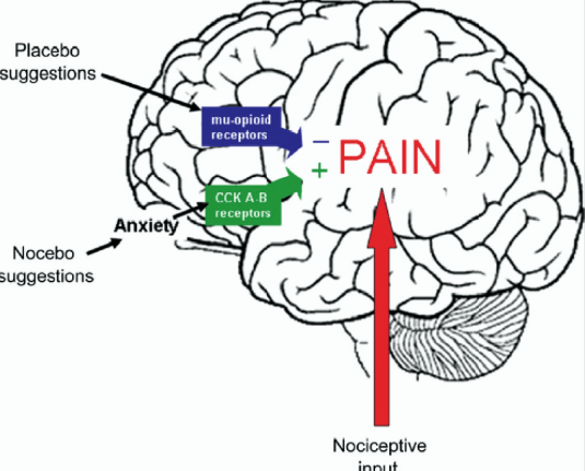 painanxiety