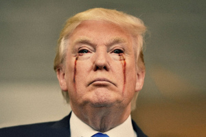 trump-his-eyes-bleeding-1