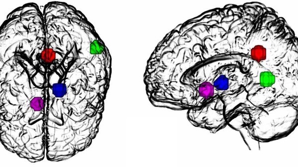 1548785981260 F1large