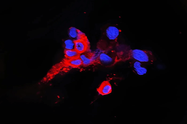 Dcb68fd0f04aef9d5571f03898e37338b6 omicron 2x rhorizontal w700 jpg