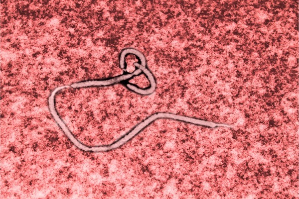Ebola virus.